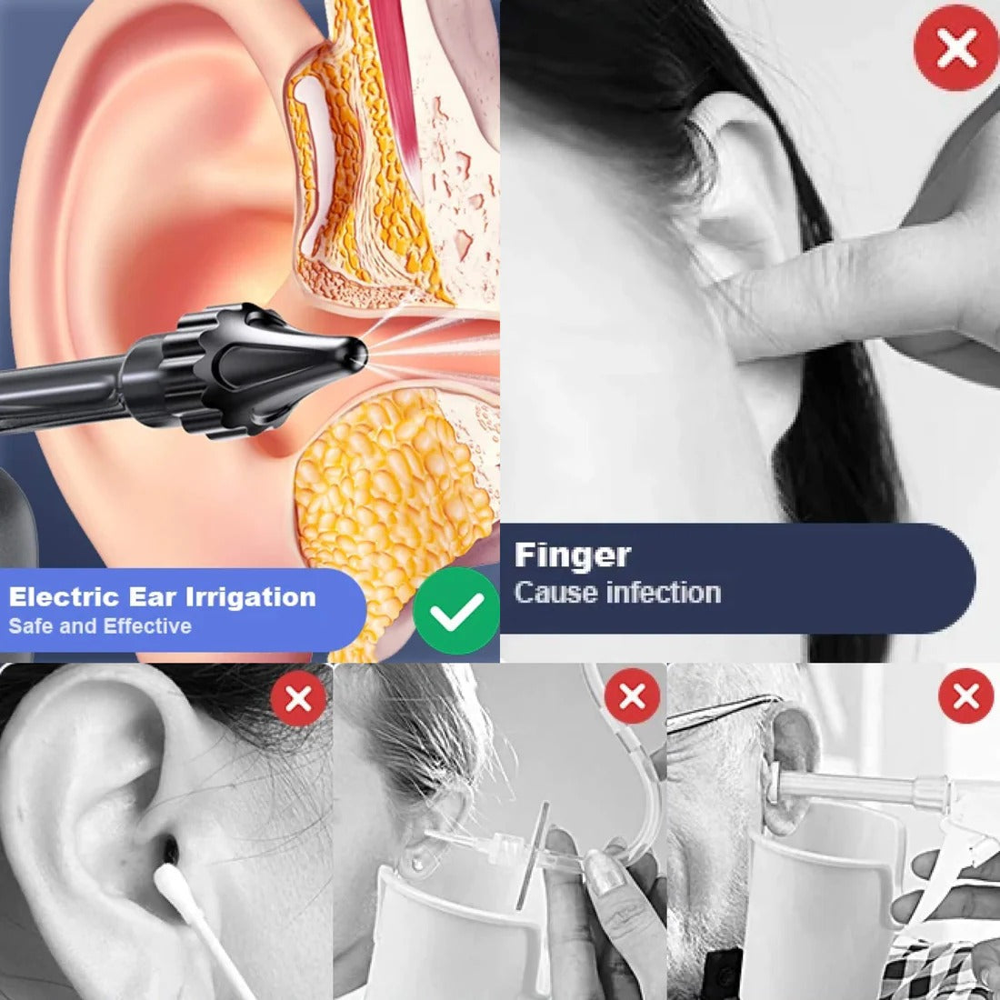 Ear Irrigation Cleaning Kit