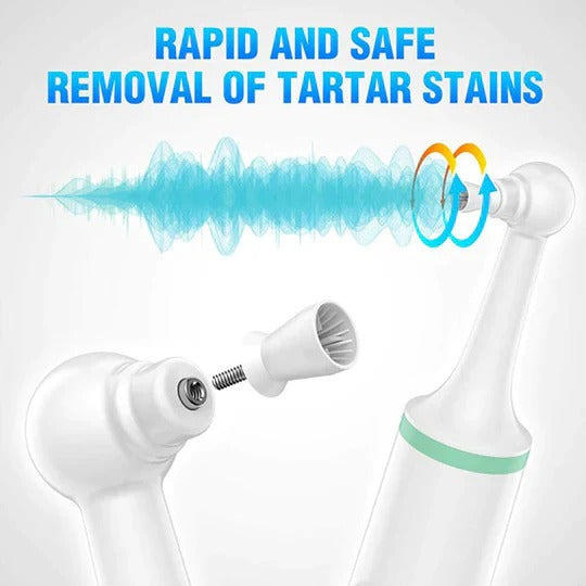 Plaque Remover for Teeth and Gums – Electric Cleaner