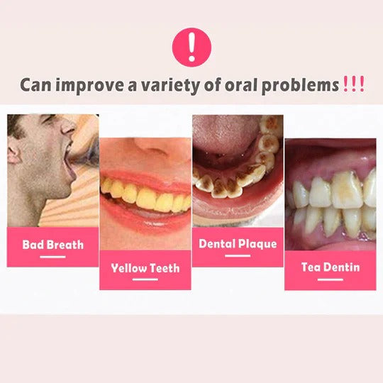 Plaque Remover for Teeth and Gums – Electric Cleaner